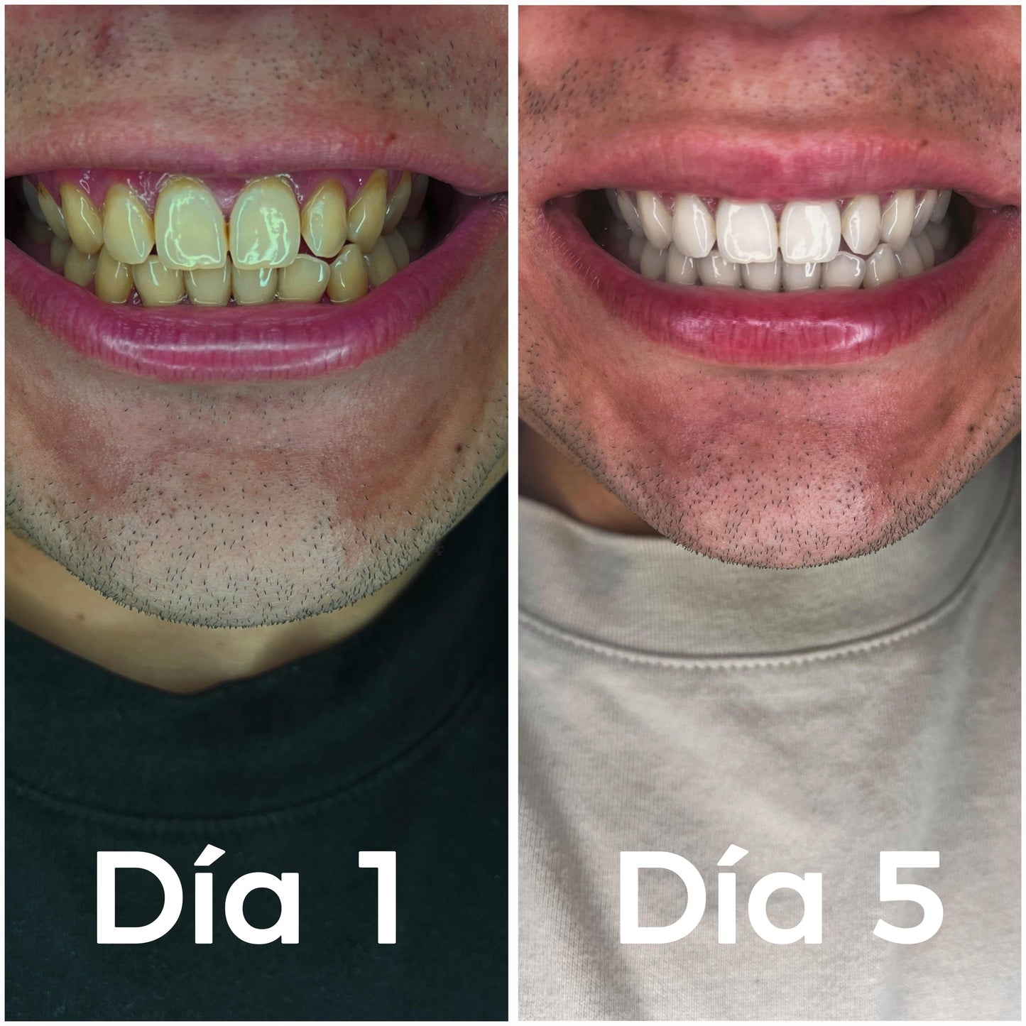 Blanqueador dental Essul + cepillo de bambú DE REGALO! + libro de guía de cuidado bucal!